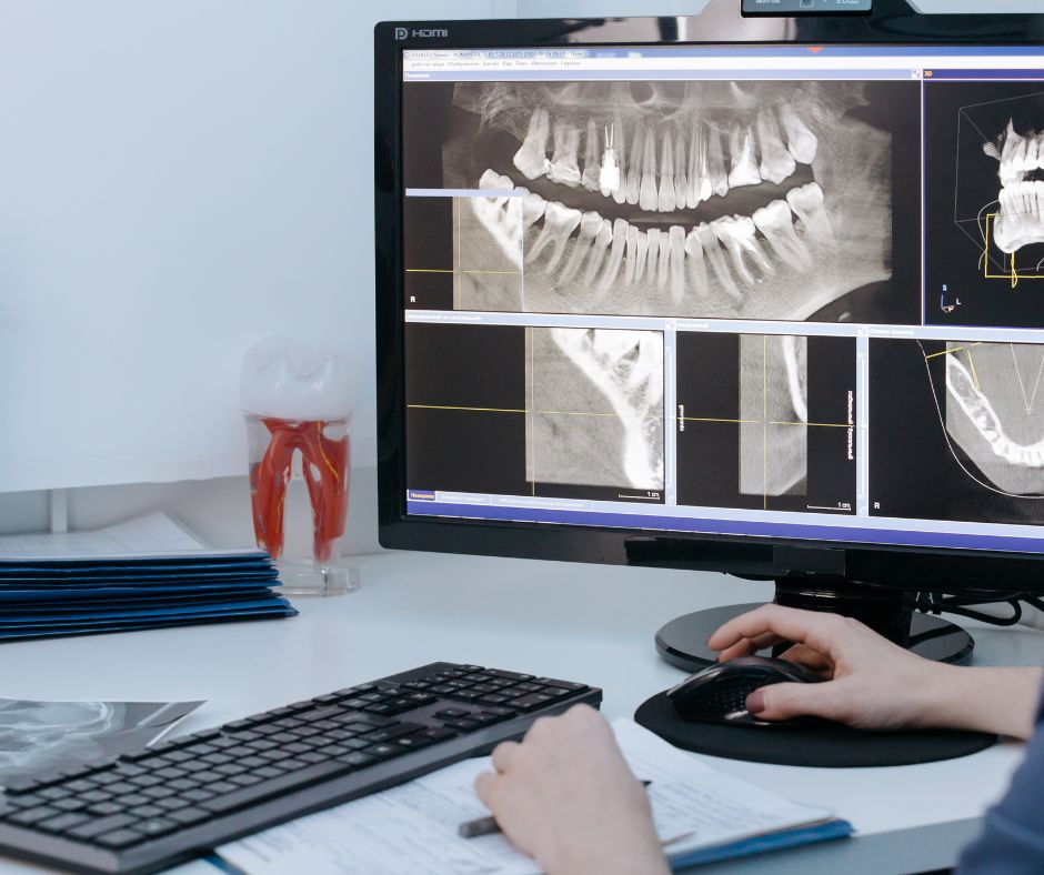 Dental X-Ray, Dr Behnam Aminnejad