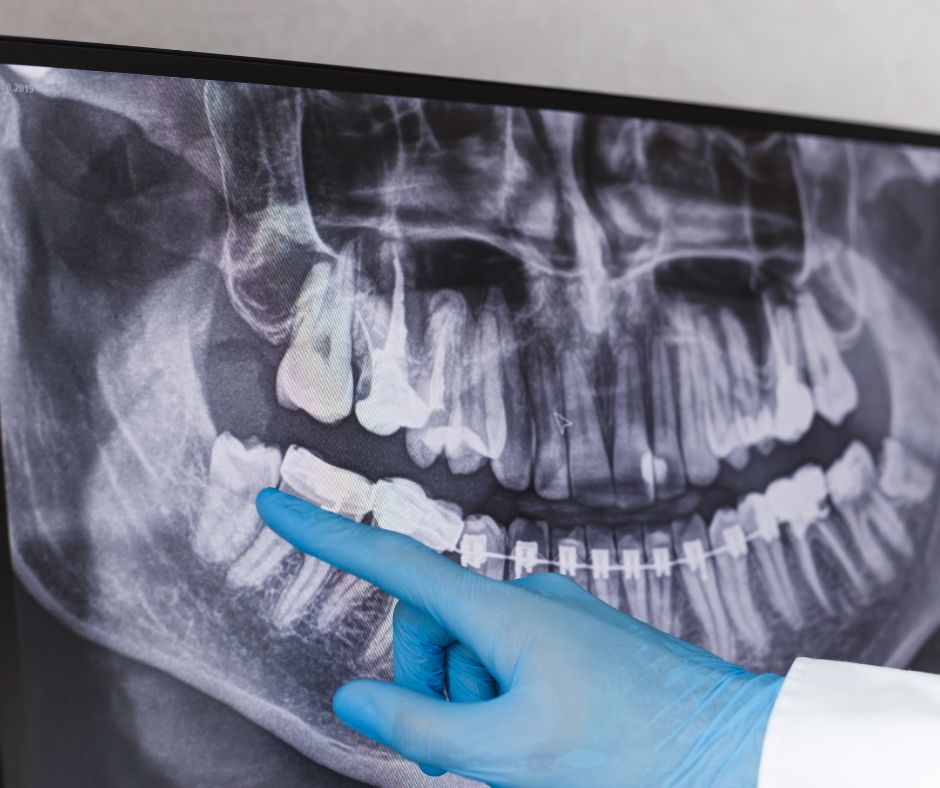 Toothache and causes, Dr Behnam Aminnejad